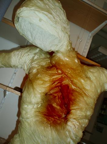 Bloody torso - Siri Sigrand