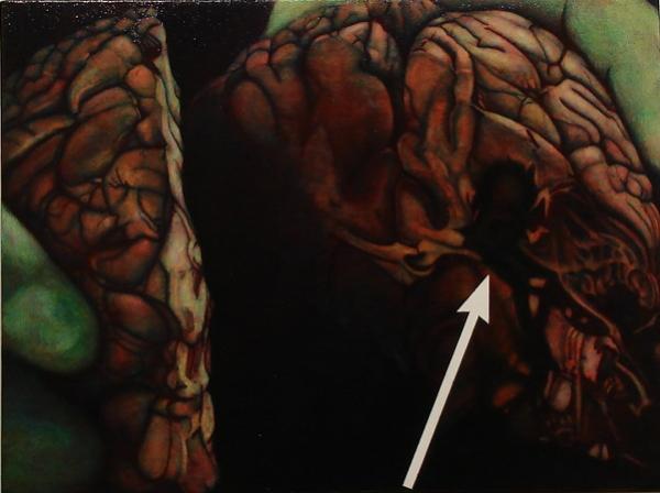 Psychosomatic Meditation - Andrew Chisholm - Click to enlarge