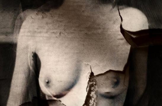 fracture - Berthier Philippe